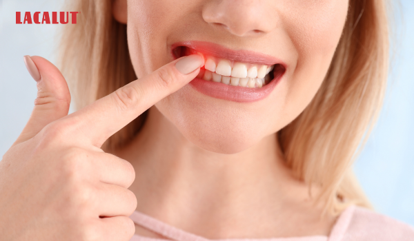 Chảy máu chân răng không cầm được phải xử lý thế nào?